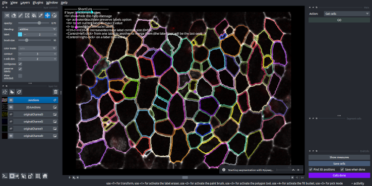 Image after segmentation